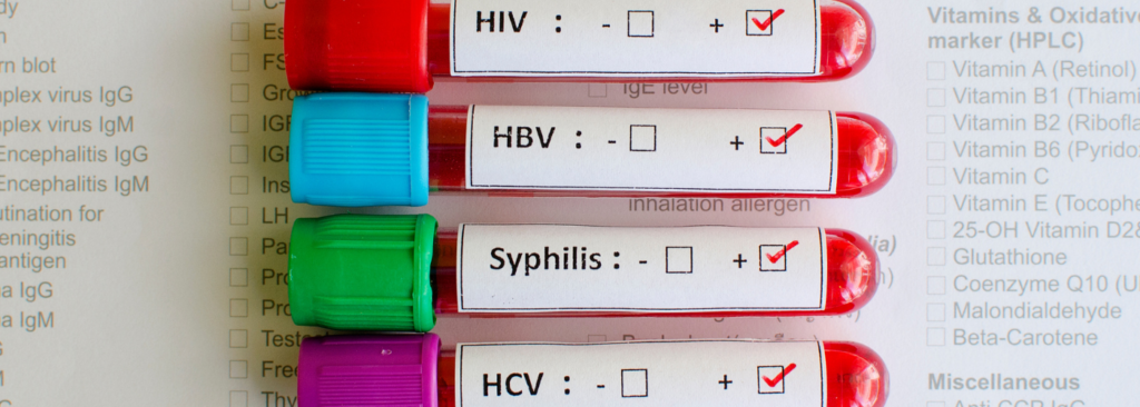 Sexually Transmitted Infections Stis